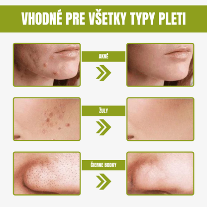 Zelená maska na tvár Ponuka 3 x 1